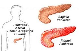 pankreas