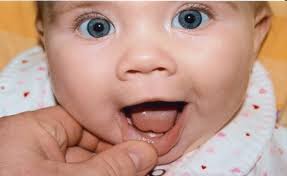 bebklerde diş çıkarma