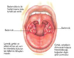 boğaz iltihabı