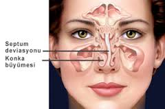 burun eğriliği