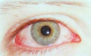 şeker-hastalığı-körlüğe-neden-oluyor